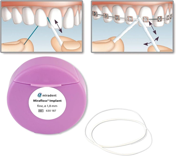 Зубная нить Miradent Implant CHX Fine 1,8 мм (Германия) НФ-00001043 фото